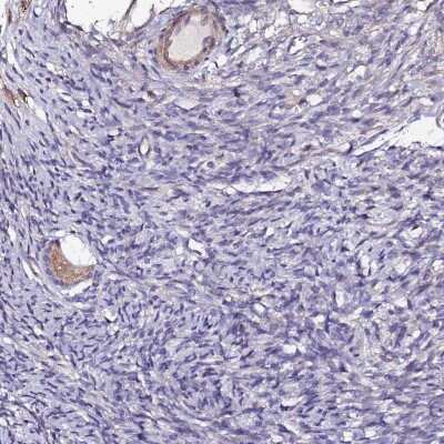 Immunohistochemistry-Paraffin: HHMJG Antibody [NBP1-91986]