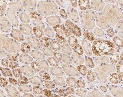 Immunohistochemistry-Paraffin: HHMJG Antibody [NBP3-12673]