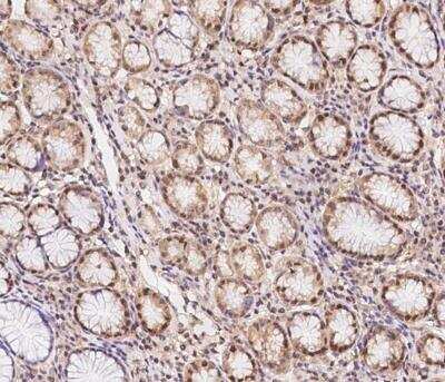 Immunohistochemistry-Paraffin: HHMJG Antibody [NBP3-12673]