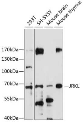 Western Blot: HHMJG AntibodyAzide and BSA Free [NBP3-03589]