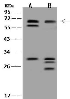 Western Blot: HHMJG Antibody [NBP3-12673]