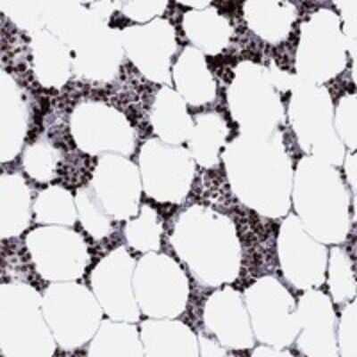 Immunohistochemistry-Paraffin: HIAT1 Antibody [NBP3-17591]