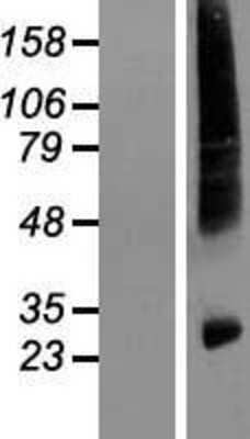 Western Blot: HIATL1 Overexpression Lysate [NBL1-11536]