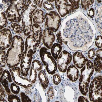 Immunohistochemistry-Paraffin: HIBADH Antibody [NBP1-80985]