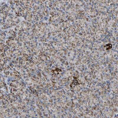 Immunohistochemistry-Paraffin: HIBADH Antibody [NBP1-80985]