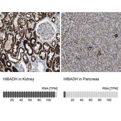 Immunohistochemistry-Paraffin: HIBADH Antibody [NBP1-80985]