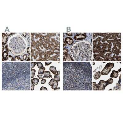Immunohistochemistry-Paraffin: HIBADH Antibody [NBP1-80985]