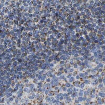 Immunohistochemistry-Paraffin: HIBADH Antibody [NBP1-80985]