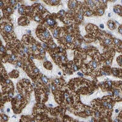 Immunohistochemistry-Paraffin: HIBADH Antibody [NBP1-80985]
