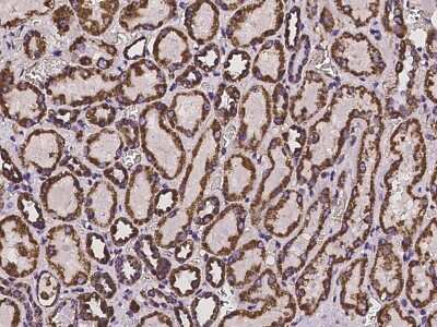 Immunohistochemistry-Paraffin: HIBADH Antibody [NBP2-97223]