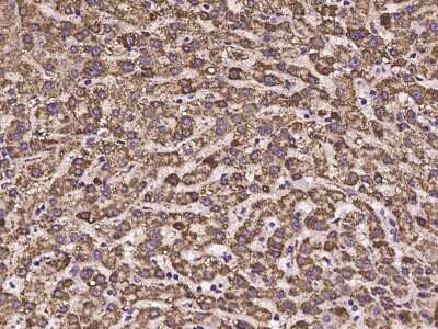 Immunohistochemistry-Paraffin: HIBADH Antibody [NBP2-97223]