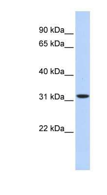 Western Blot: HIBADH Antibody [NBP1-54786]