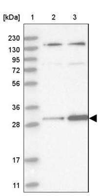 Western Blot: HIBADH Antibody [NBP1-82526]