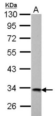 Western Blot: HIBADH Antibody [NBP2-16827]