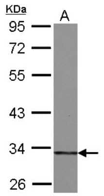 Western Blot: HIBADH Antibody [NBP2-16827]