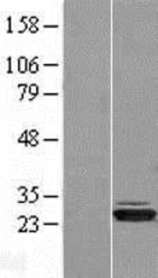 Western Blot: HIBADH Overexpression Lysate [NBP2-05311]