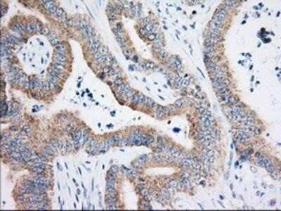Immunohistochemistry-Paraffin: HIBCH Antibody (OTI3H5) [NBP2-02673]