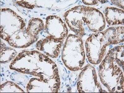 Immunohistochemistry-Paraffin: HIBCH Antibody (OTI3H5) [NBP2-02673]