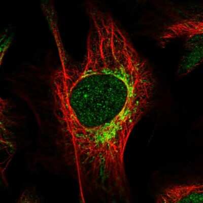 Immunocytochemistry/ Immunofluorescence: HIBCH Antibody [NBP1-85891]