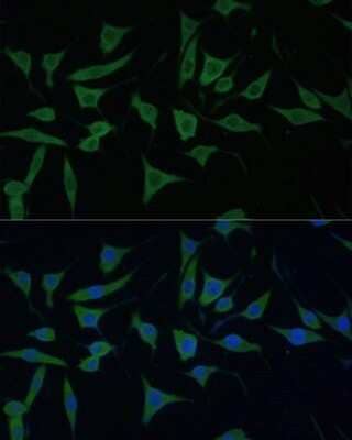 Immunocytochemistry/ Immunofluorescence: HIBCH Antibody - Azide and BSA Free [NBP3-15496]