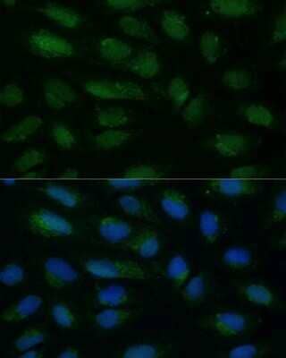 Immunocytochemistry/ Immunofluorescence: HIBCH Antibody - Azide and BSA Free [NBP3-15496]