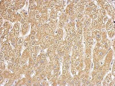 Immunohistochemistry-Paraffin: HIBCH Antibody [NBP1-32964]