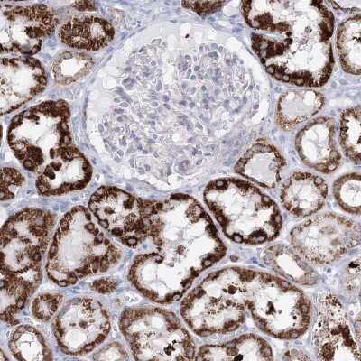 Immunohistochemistry-Paraffin: HIBCH Antibody [NBP1-85891]