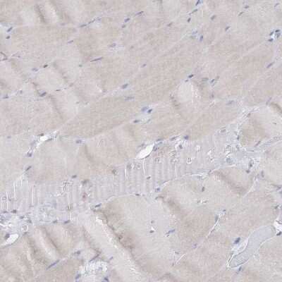 Immunohistochemistry-Paraffin: HIBCH Antibody [NBP1-85891]