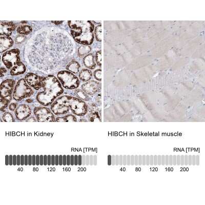 Immunohistochemistry-Paraffin: HIBCH Antibody [NBP1-85891]