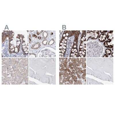 Immunohistochemistry-Paraffin: HIBCH Antibody [NBP1-85891]