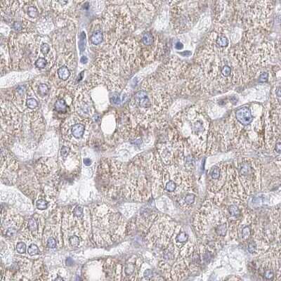 Immunohistochemistry-Paraffin: HIBCH Antibody [NBP1-85891]
