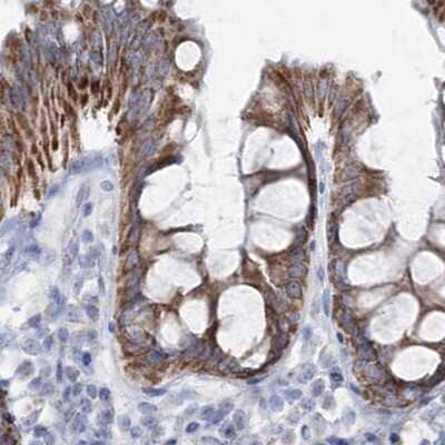 Immunohistochemistry-Paraffin: HIBCH Antibody [NBP1-85891]