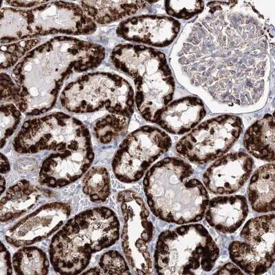 Immunohistochemistry-Paraffin: HIBCH Antibody [NBP2-32669]