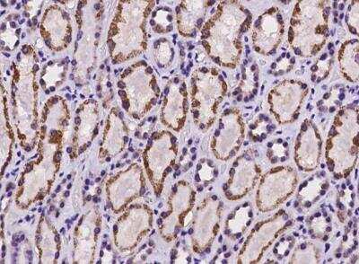 Immunohistochemistry-Paraffin: HIBCH Antibody [NBP3-06399]
