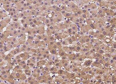 Immunohistochemistry-Paraffin: HIBCH Antibody [NBP3-06399]