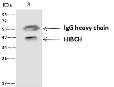 Immunoprecipitation: HIBCH Antibody [NBP3-06399]