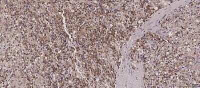 Immunohistochemistry: HIBCH Antibody (OTI3H5) - Azide and BSA Free [NBP2-71796]