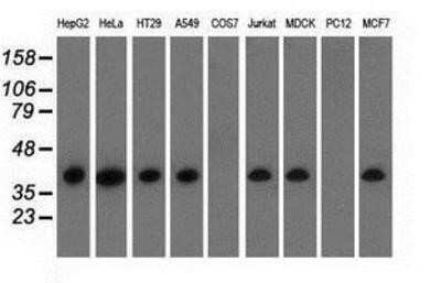 Western Blot: HIBCH Antibody (OTI3H5)Azide and BSA Free [NBP2-71796]