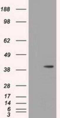 Western Blot: HIBCH Antibody (OTI3H5)Azide and BSA Free [NBP2-71796]