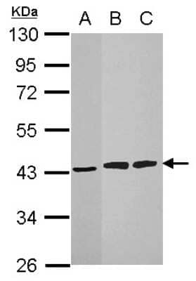 Western Blot: HIBCH Antibody [NBP1-32964]