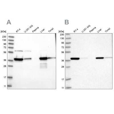 Western Blot: HIBCH Antibody [NBP2-32669]