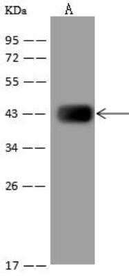 Western Blot: HIBCH Antibody [NBP3-06399]