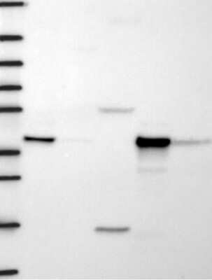 Western Blot: HIBCH Antibody [NBP3-17865]