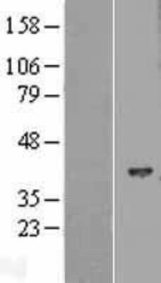 Western Blot: HIBCH Overexpression Lysate [NBL1-11538]