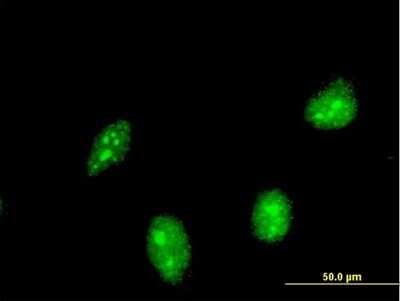 Immunocytochemistry/ Immunofluorescence: HIC1 Antibody (1E11) [H00003090-M03]