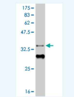 Western Blot: HIC1 Antibody (1F2) [H00003090-M05]