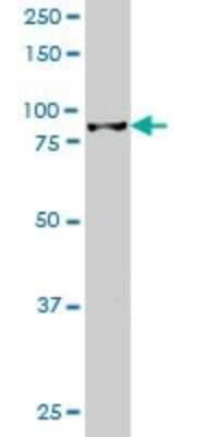 Western Blot: HIC1 Antibody (2F9) [H00003090-M02]