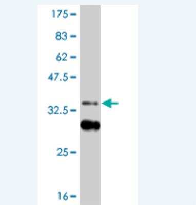 Western Blot: HIC1 Antibody (3B2) [H00003090-M06]