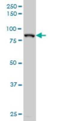 Western Blot: HIC1 Antibody (4E11) [H00003090-M01]