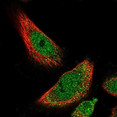 Immunocytochemistry/ Immunofluorescence: HIC1 Antibody [NBP1-80607]